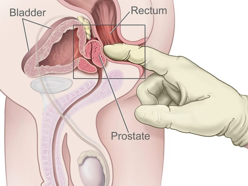 prostatas-masaza-2